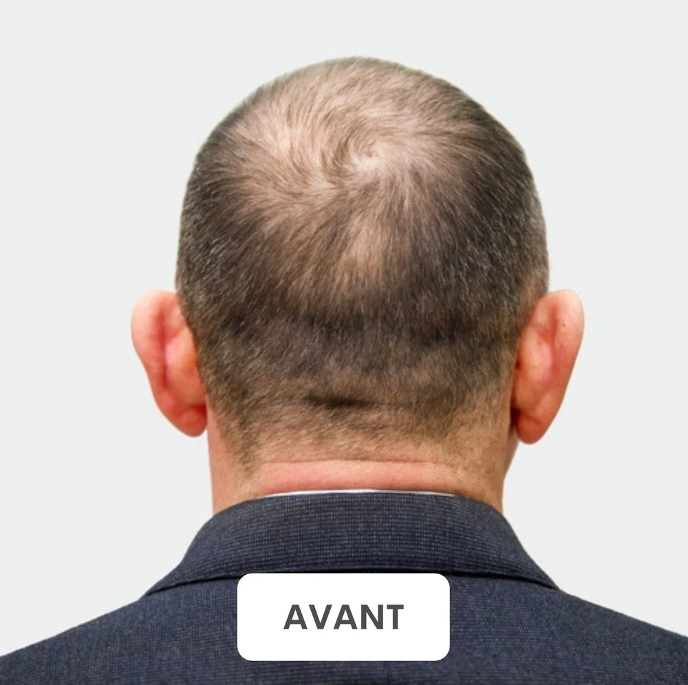 Résultat avant