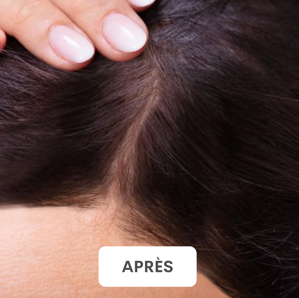 Résultat après