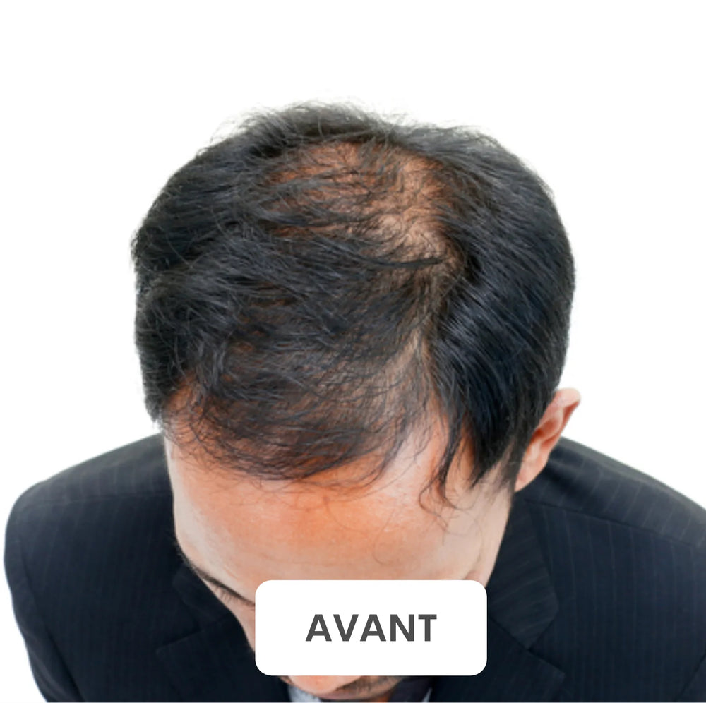 Résultat avant