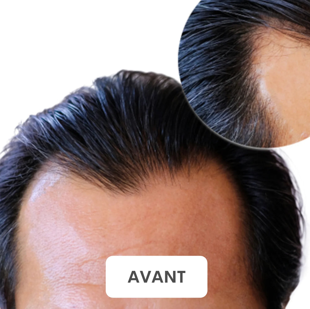 Résultat avant