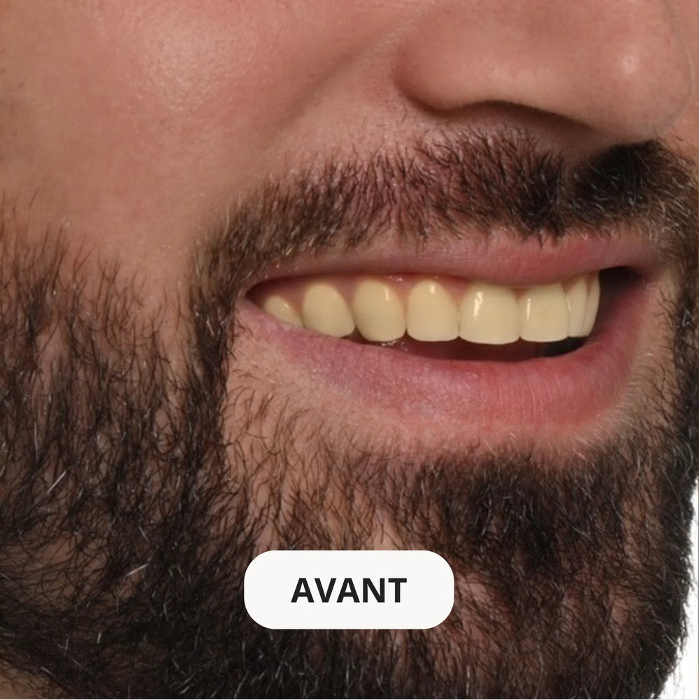 Résultat avant