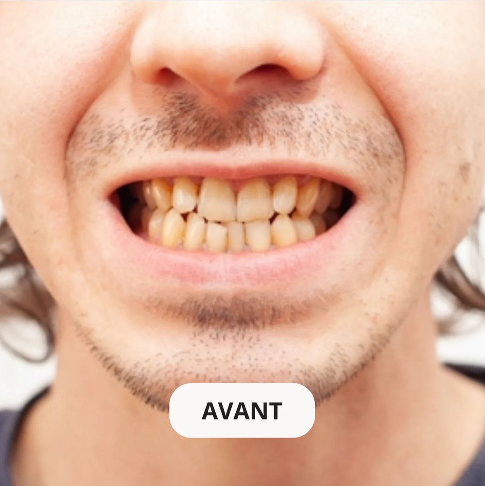 Résultat avant