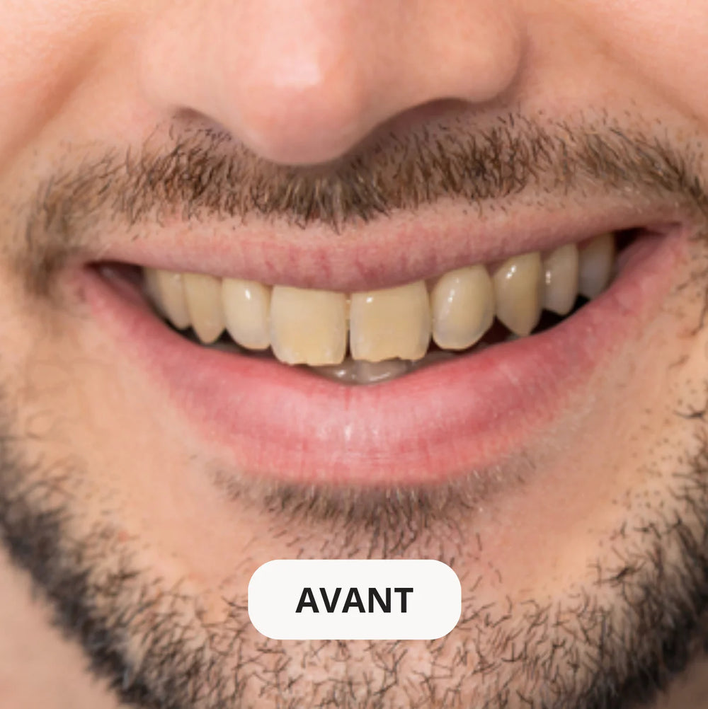 Résultat avant