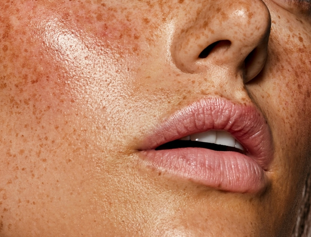 Effet taches de rousseur naturel après dermopigmentation
