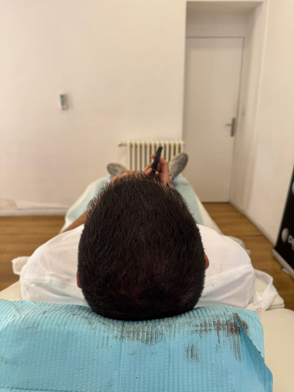 Après densification : vue du sommet de la tête avec les cheveux coiffés différemment