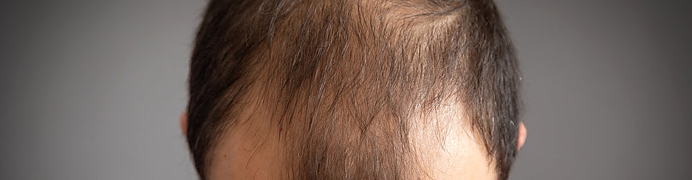 <span style="color:#FFFFFF;">DERMOPIGMENTATION CAPILLAIRE MARSEILLE</span>