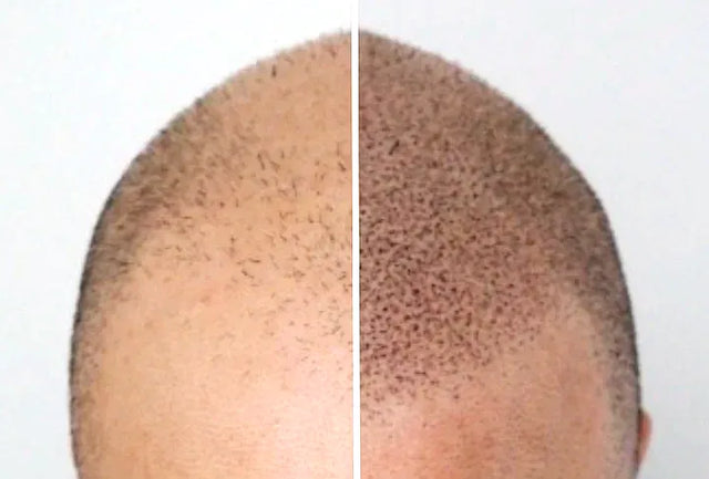 EFFET CRÂNE RASÉ
