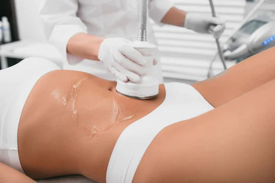 Lipocavitation