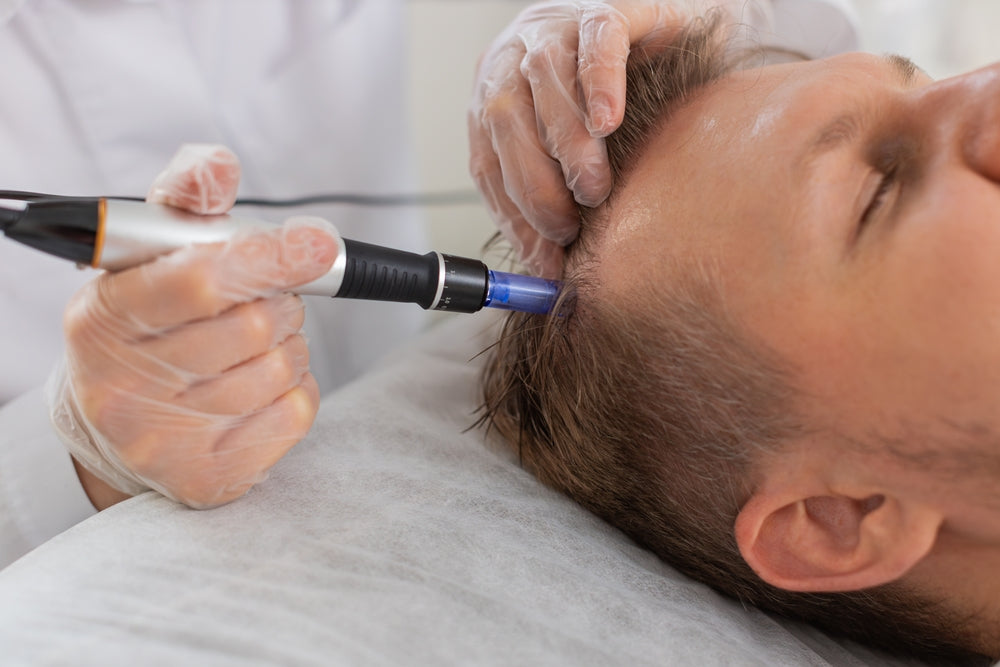 Formation Hair Needling
