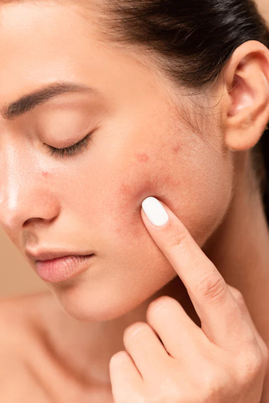 Résultat de camouflage de cicatrice par dermopigmentation