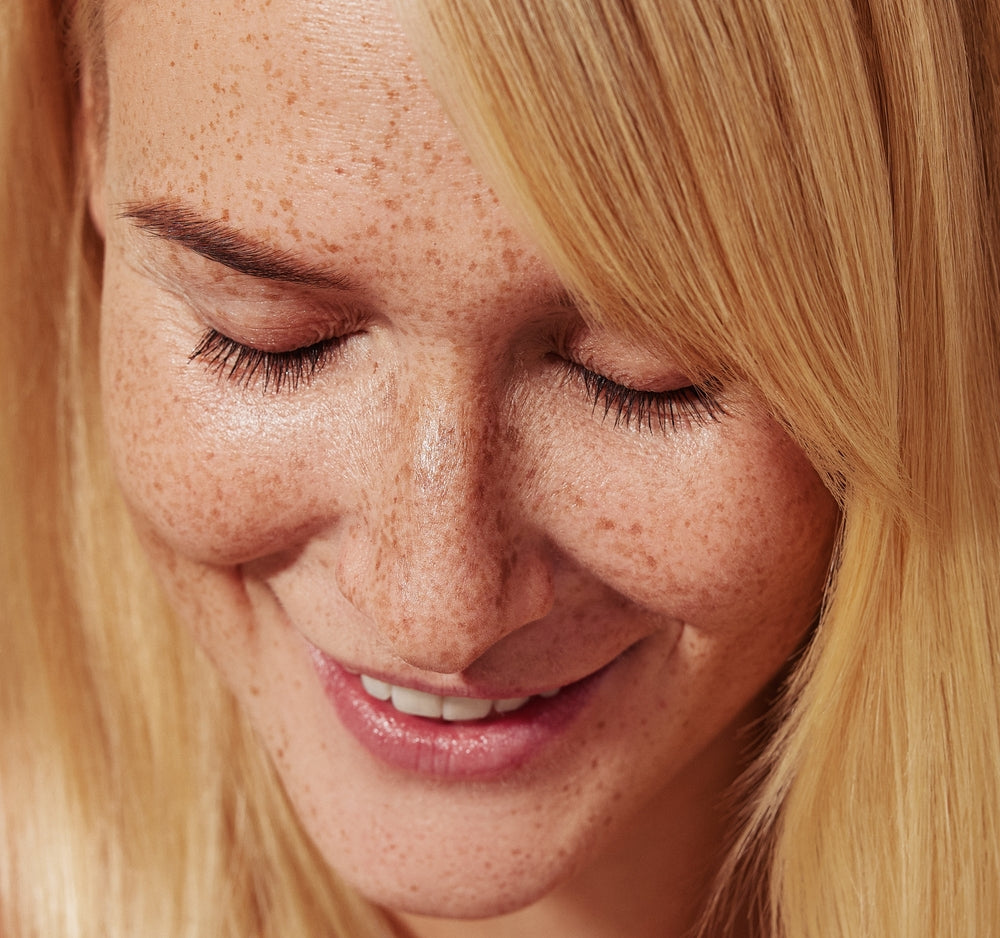 Dermopigmentation des taches de rousseur