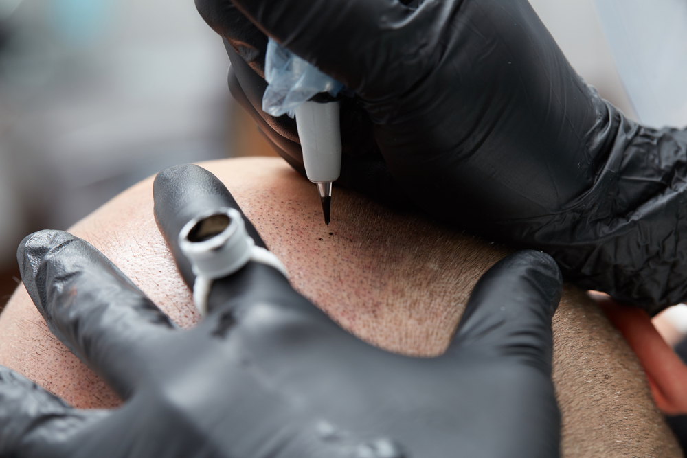 Prestation de tricopigmentation capillaire à Marseille