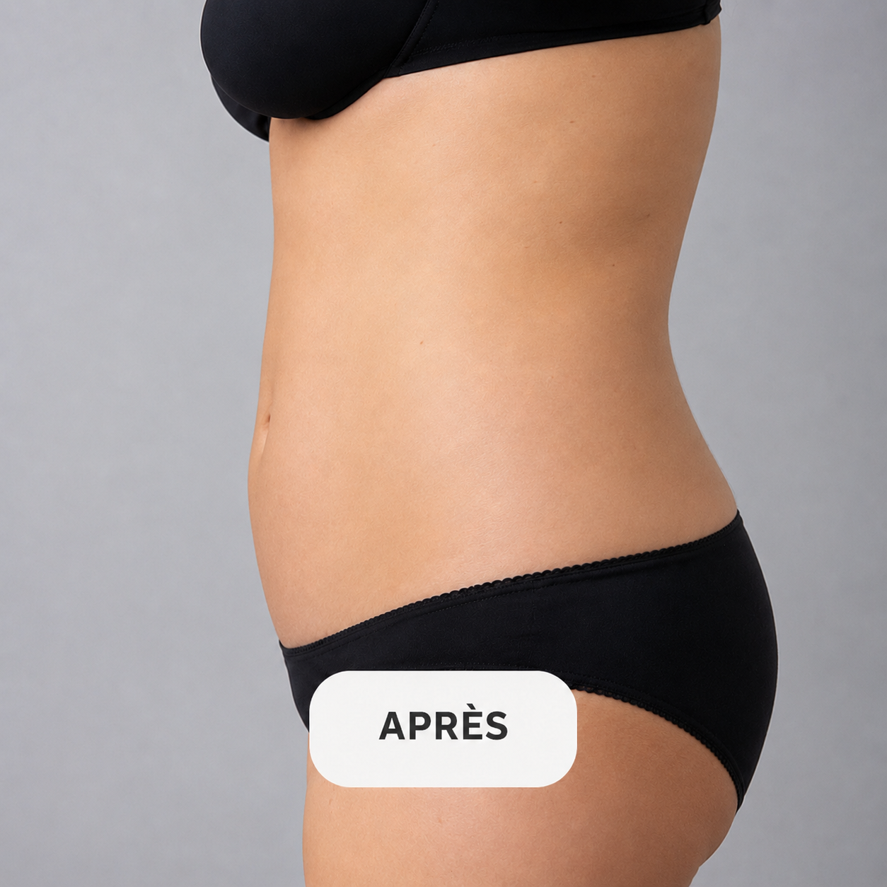 Après tonification musculaire Marseille