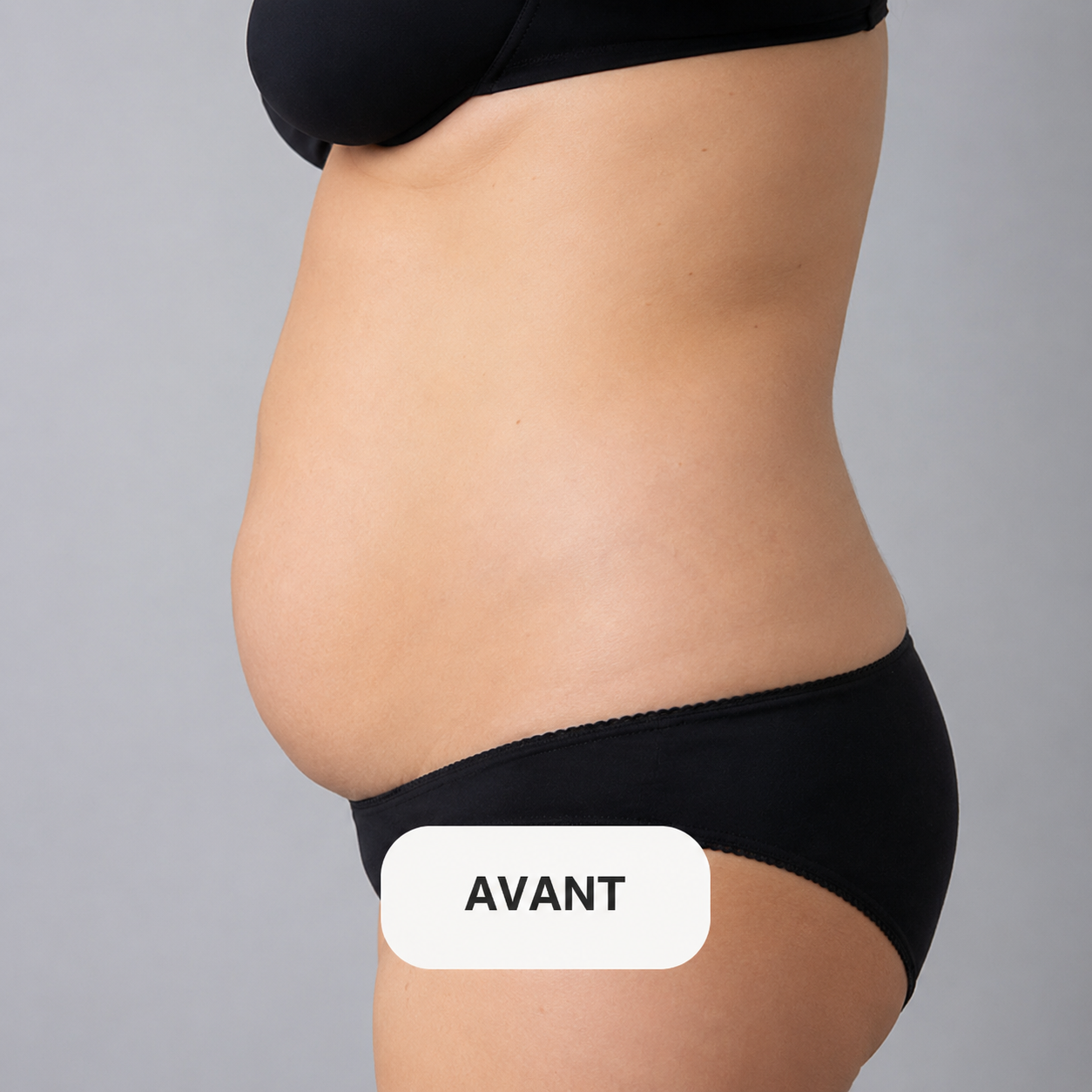 Avant tonification musculaire Marseille